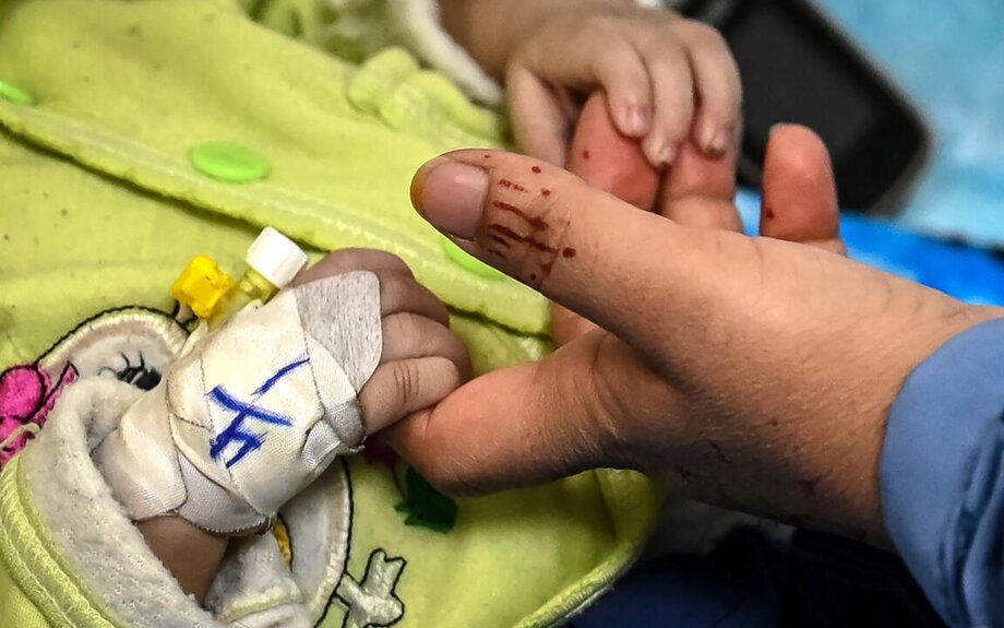 Afghanistan : un million d'enfants en danger de mort à cause de la malnutrition, selon ...